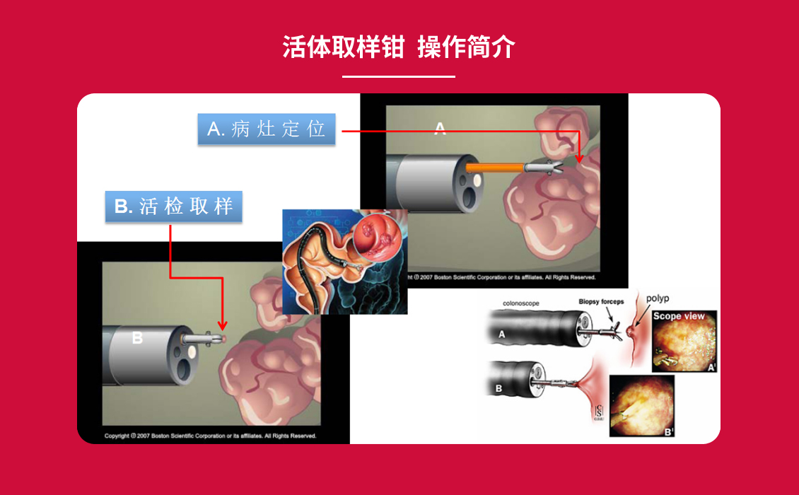 JHY型一次性使用活體取樣鉗_08.jpg