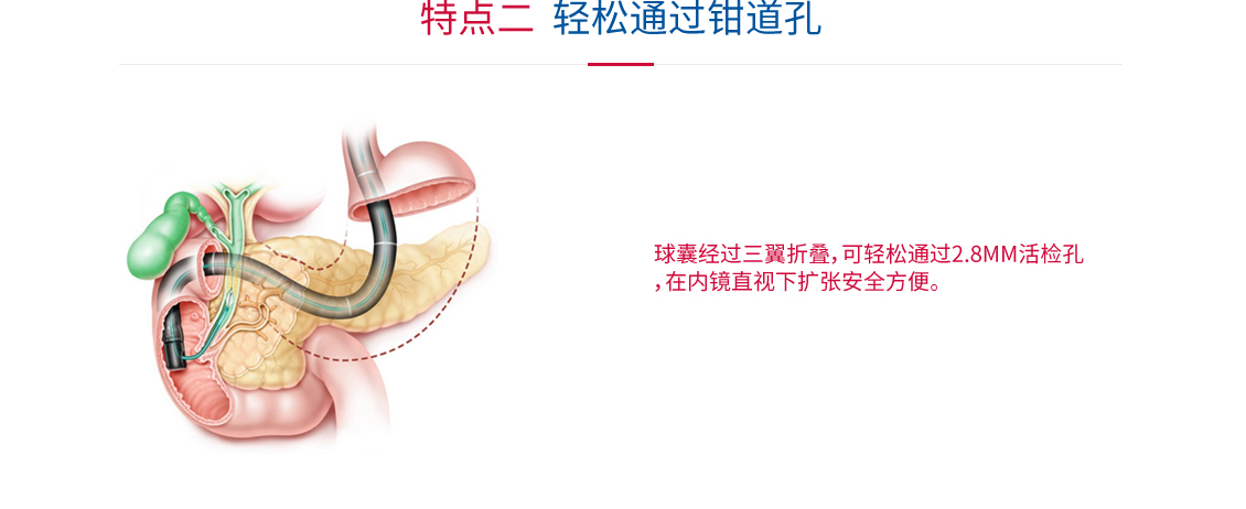 球囊擴(kuò)張導(dǎo)管_07.jpg