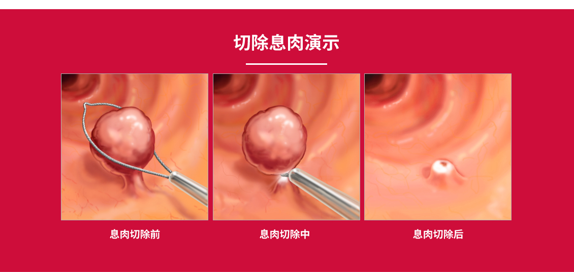 圈套器_15.jpg